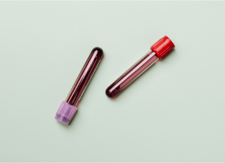 What Can Your Blood Tell You About Your Brain