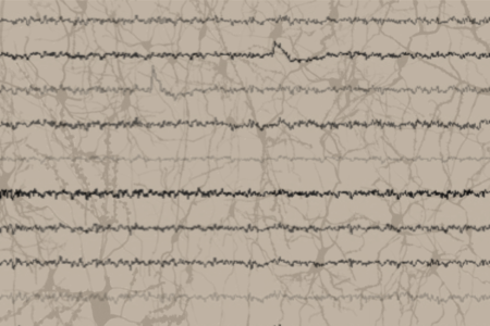 EEG